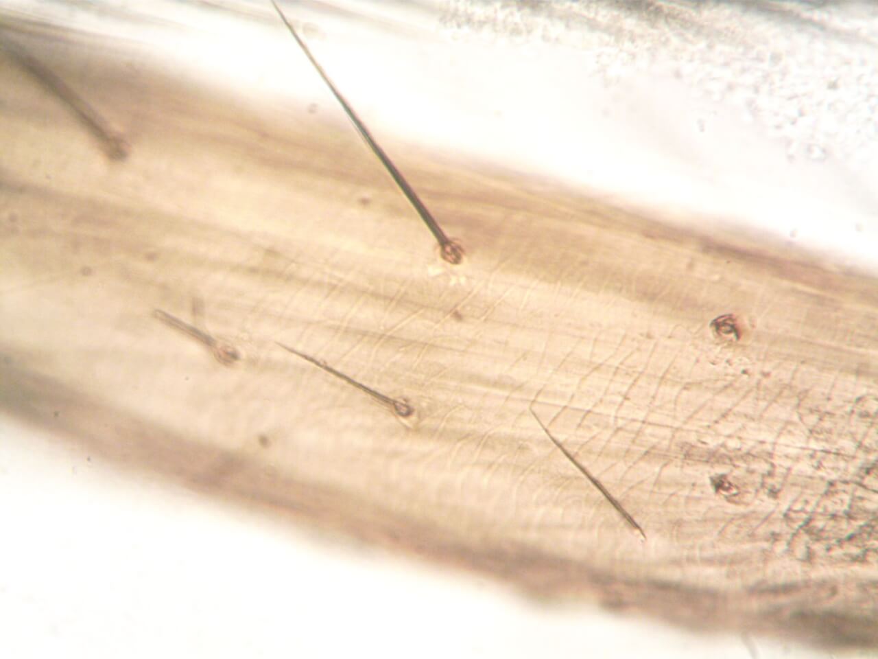 La morphologie générale des puces : un corps taillé pour la survie